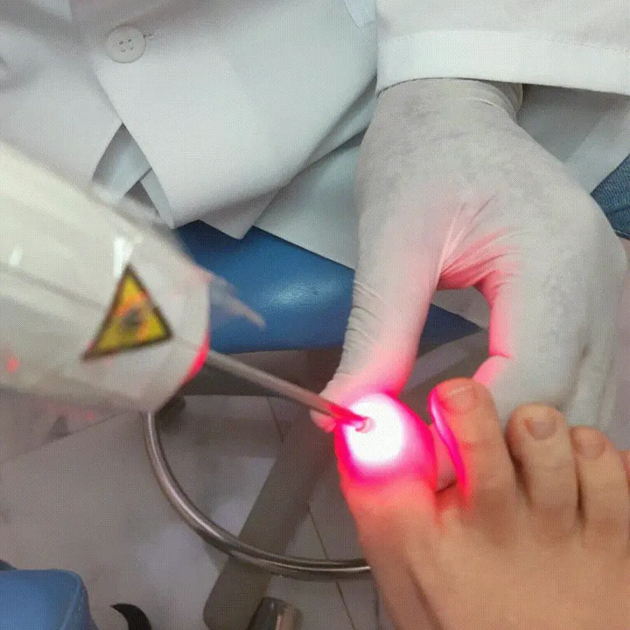 Laserterapia na unidade de Hortolândia